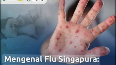 MENGENAL FLU SINGAPURA : Penyebab, Gejala , dan Pencegahannya